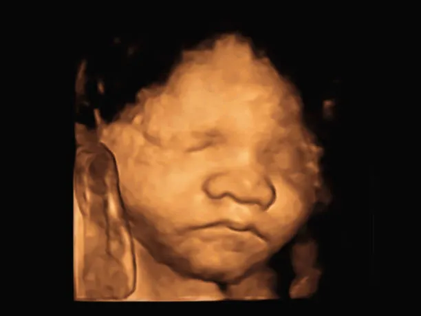 Example ultrasound image